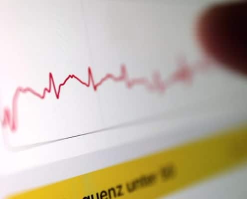 EKG App